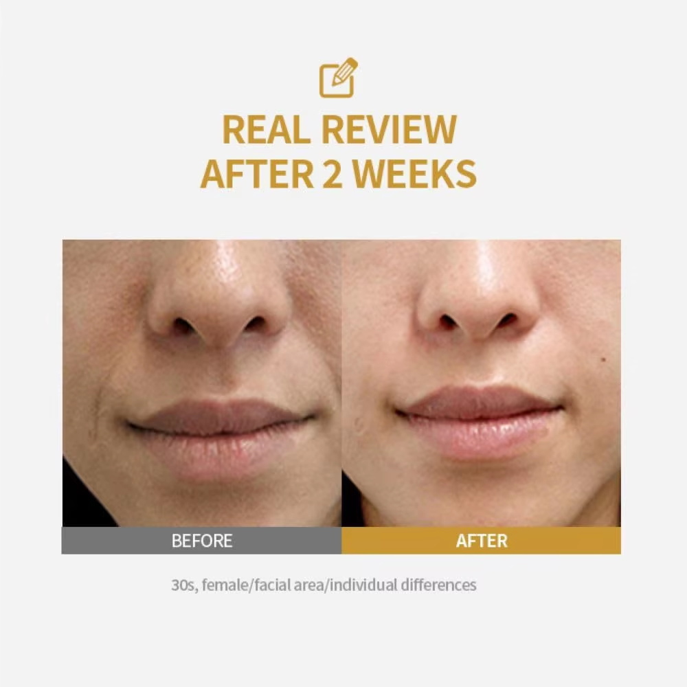 Peptide Intensive Lifting Ampo - Peptide Complex Serum recension och pris