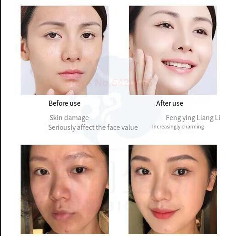 0.25 mm Microneedle GHK-Cu Blu - Peptide Complex Serum recension och pris